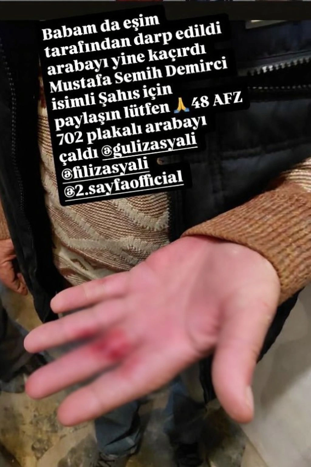 Ağ Ev: Tramp Ukrayna münaqişəsinin həlli üzərində fəal çalışır