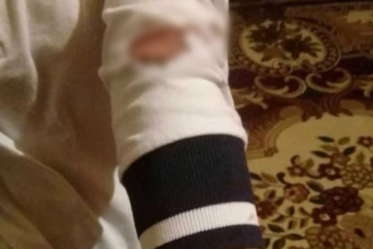 Məktəbdə şagirdin özünə xəsarət yetirdiyi üzə çıxıb