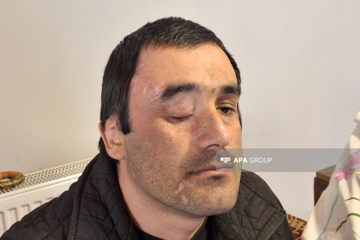 Kürdəmirdə Vətən müharibəsi qazisi səsvermədə iştirak edib - FOTO